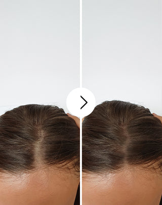 Capsules voor haaruitval met verdikkende en versterkende werking, Follixin 60 capsules_4 - 4