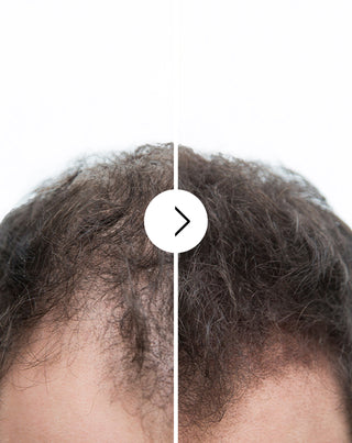 Capsules voor haaruitval met verdikkende en versterkende werking, Follixin 60 capsules_2 - 2