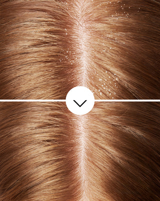 Anti-roos haarshampoo met olamine pyrocton met hydraterende werking van Nutridome - 5