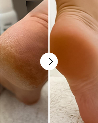 Nutridome verzachtende voetcrème met urea en sheaboter - 4