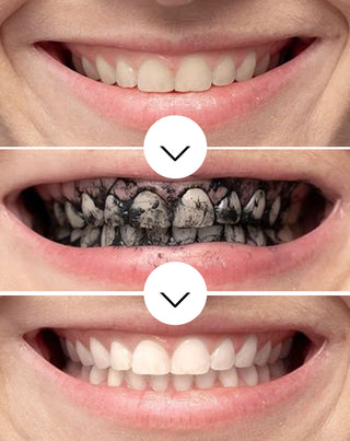 Smilebite kokosnoot houtskool tandenbleekpoeder