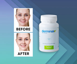 Tabletten voor acne, puistjes en onvolkomenheden met zink, vitamine C, E en B2 van Derminax - 2