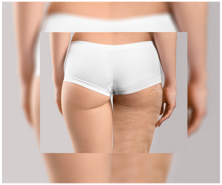 Tabletten voor cellulitis en het verbeteren van de huidconditie met natuurlijke extracten, Cellinea 60 capsules - 6