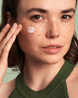 AcneCrème met 10% azelaïnezuur Solve On voor acne en verkleuringen Health Labs Care - 2