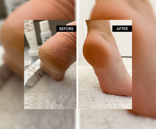 Refeet verkoelende voetgel met eucalyptusolie