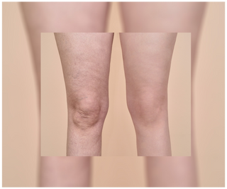 Tabletten voor cellulitis en het verbeteren van de huidconditie met natuurlijke extracten, Cellinea 60 capsules - 4