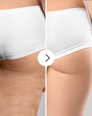 Tabletten voor cellulitis en het verbeteren van de huidconditie met natuurlijke extracten, Cellinea 60 capsules_3 - 3