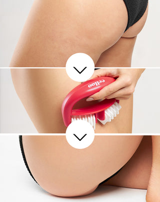 Anticellulitis massager met knobbels, bestrijdt cellulitis en vermindert spierspanning Crush my Celloo