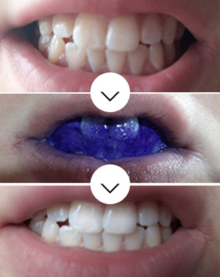 White Bite Smilebite tandkleurcorrigerend serum 30 ml - 2